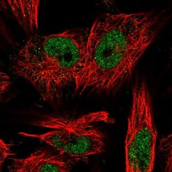 LRP5L Antibody, Novus Biologicals:Antibodies:Primary Antibodies